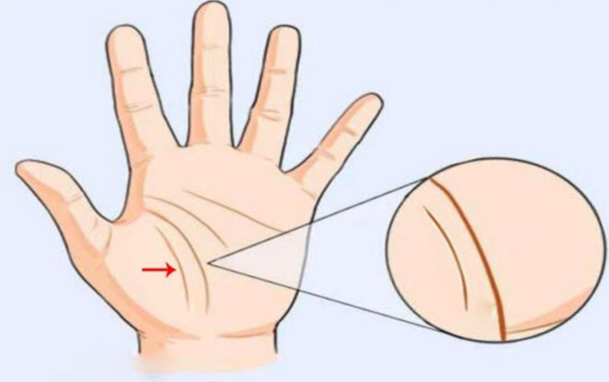 Độ cong của đường sinh mệnh